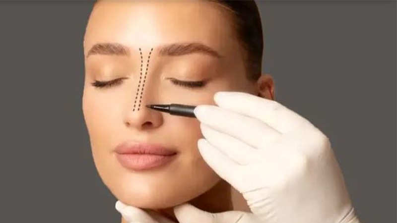 مرکز رینوپلاستی در ونک | جراحی بینی طبیعی و متناسب با چهره