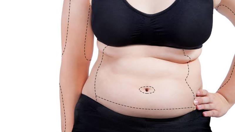 مرکز پیکرتراشی شکم و پهلو | جراحی زیبایی بدن