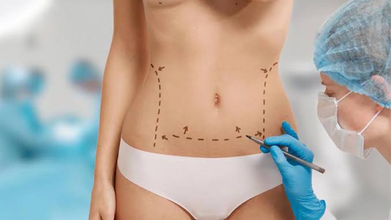 پیکرتراشی شکم و پهلو | روش‌های فرم‌ دهی بدن