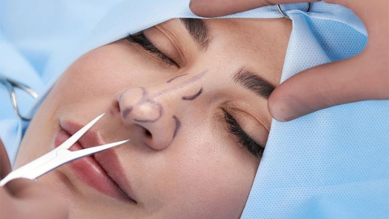 عمل بینی گوشتی | جراحی بینی گوشتی و نتیجه عمل
