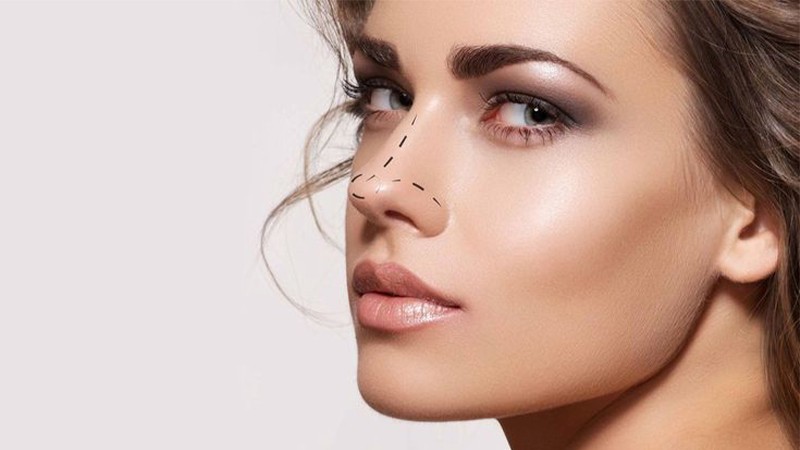عمل بینی استخوانی در ونک | اصلاح قوز و فرم بینی